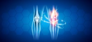 joint replacement center orthopedics conway