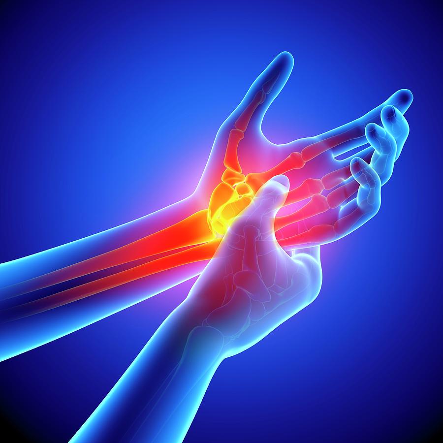 Orthopedic Wrist & Hand Specialists | Conway SC