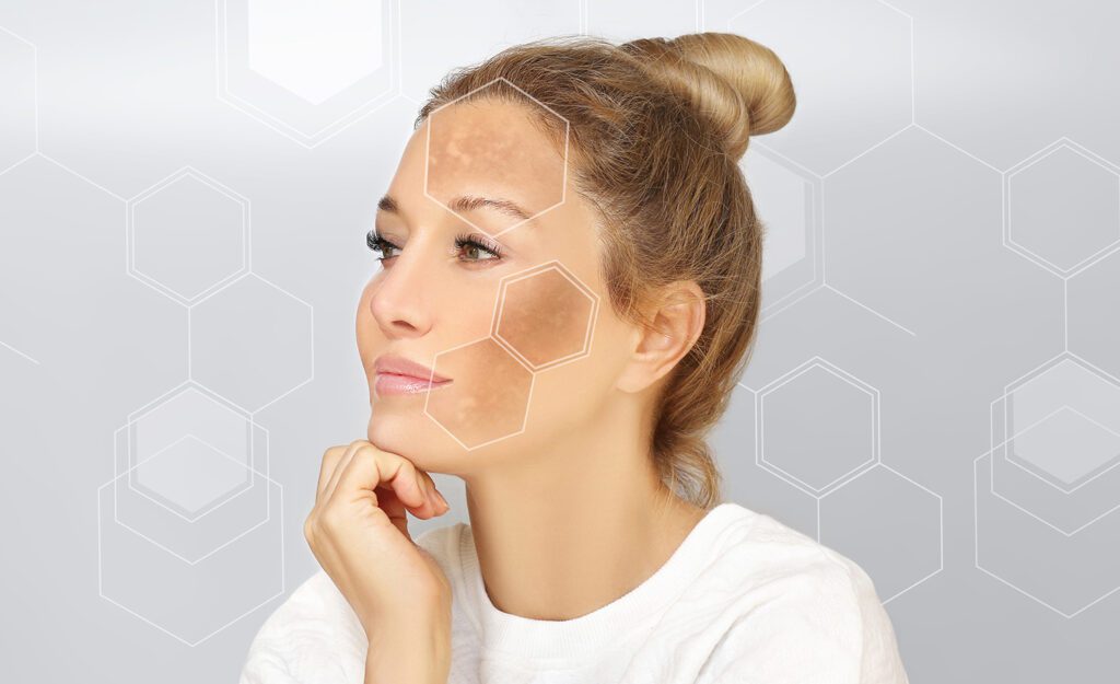 https://www.conwaymedicalcenter.com/wp-content/uploads/2023/09/Skin-Discoloration_540055439-1024x625.jpg