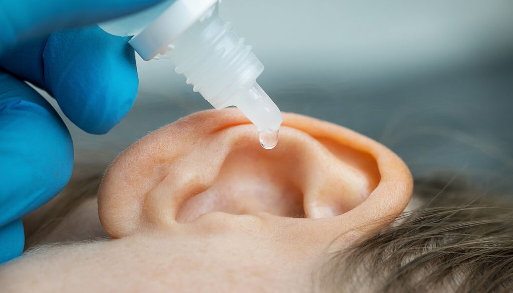 Closeup of a Doctor Wearing Blue Gloves Dripping Ear Drops Into a Patient’s Ear Can Earwax Cause Tinnitus